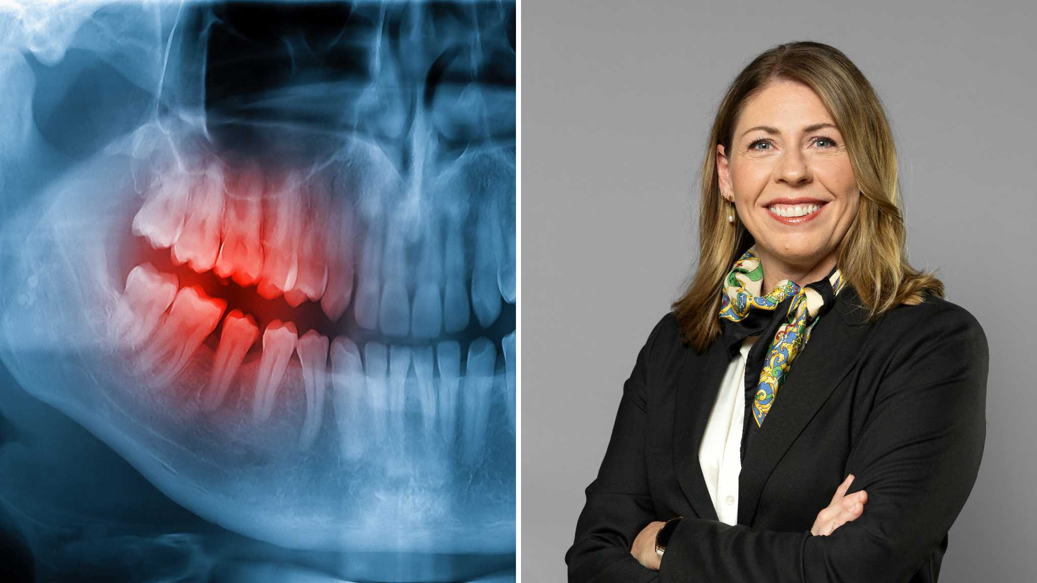 Var fjärde har inte råd med tandvård – kan avgöra valet